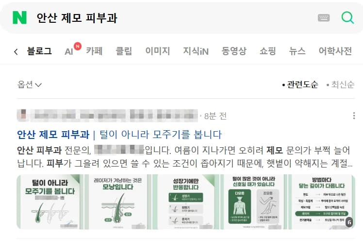 안산 제모 피부과 1페이지 노출 화면